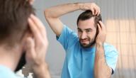 أسباب جفاف فروة الرأس أسباب جفاف فروة الرأس