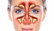 التهابات الجيوب الأنفية أنواعها وطرق علاجها التهابات الجيوب الأنفية أنواعها وطرق علاجها