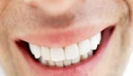 أضرار تركيب الأسنان الثابتة أضرار تركيب الأسنان الثابتة