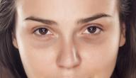 طريقة لإزالة السواد تحت العين في أسبوع