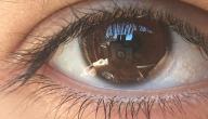 طريقة تخفيف صبغة الميلانين في العين طريقة تخفيف صبغة الميلانين في العين