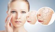 طرق علاج البشرة الجافة طرق علاج البشرة الجافة