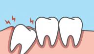طرق علاج الضرس الملتهب طرق علاج الضرس الملتهب