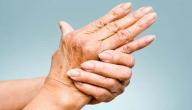 طرق علاج الروماتيزم طرق علاج الروماتيزم