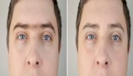 حكم إزالة الشعر بين الحاجبين للرجل حكم إزالة الشعر بين الحاجبين للرجل