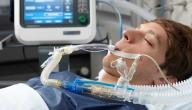 ما هو التنفس الصناعي ما هو التنفس الصناعي