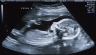 متى يظهر نبض الجنين في سونار البطن