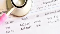 هل هناك علاقة بين تحليل TSH والحمل؟ هل هناك علاقة بين تحليل TSH والحمل؟