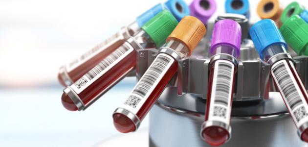 رجيم فصيلة الدم O +