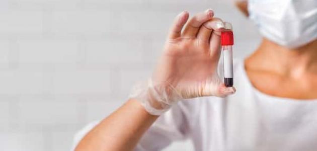 معلومات عن الأمراض الجنسية