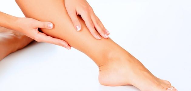 أعراض دوالي الساقين