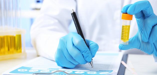 علاج زلال البول