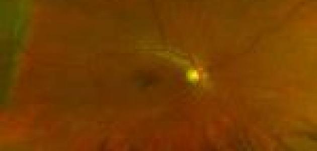 ����� ���� ������� ط£ط%C