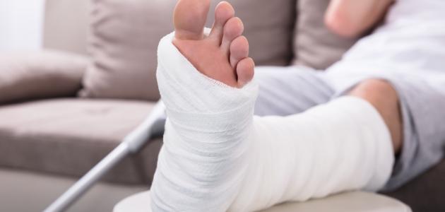 العلاج الطبيعي للقدم بعد الجبس سطور