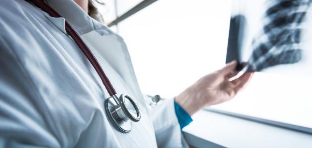 أعراض سرطان الرئة
