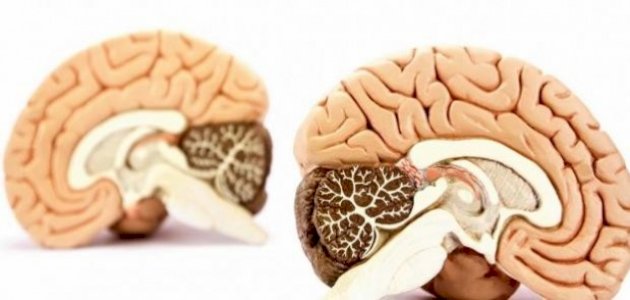 النخاع المستطيل: تعريف، موقع، وظائف، أمراض شائعة وكيفية الحفاظ عليه